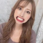 【歯科医が監修】サロンが開発した自宅でできる簡単ホワイトニング